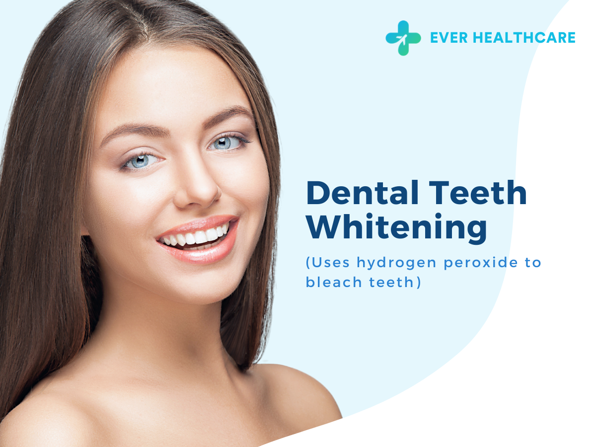 Dental Teeth Whitening in Thailand 2023 Compare Price & Reviews Ever